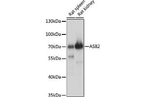 Western blot analysis of extracts of various cell lines, using  antibody (ABIN7265612) at 1:1000 dilution. (ASB2 antibody  (AA 448-587))