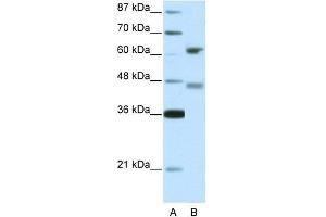 Human 293T; WB Suggested Anti-RFX4 Antibody Titration: 5. (RFX4 antibody  (Middle Region))