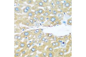 Immunohistochemistry of paraffin-embedded mouse liver using  antibody (ABIN6129195, ABIN6137096, ABIN6137097 and ABIN6220538) at dilution of 1:100 (40x lens). (ARHGEF5 antibody  (AA 1248-1597))