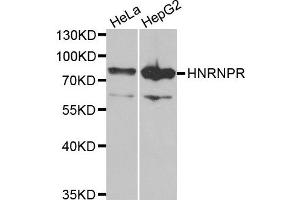 Western blot analysis of extracts of HeLa and HepG2 cell lines, using HNRNPR antibody. (HNRNPR antibody)