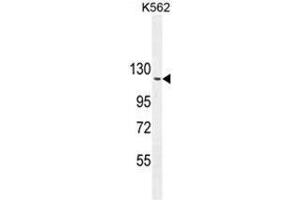 ARHGAP17 Antibody (N-term) western blot analysis in K562 cell line lysates (35µg/lane).