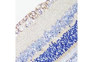 Immunohistochemistry of paraffin-embedded rat retina using DRD4 antibody (ABIN1679595, ABIN5663875, ABIN5663877 and ABIN6217338) at dilution of 1:100 (40x lens). (DRD4 antibody  (AA 100-200))