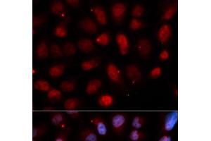 Immunofluorescence analysis of U2OS cells using Pea3 / ETV4 Polyclonal Antibody (ETV4 antibody)