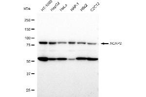 Western blotting analysis using ACAP2 antibody (ABIN7797642). (Recombinant Centaurin beta 2 antibody)