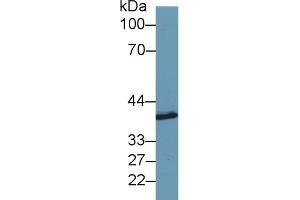 Detection of SYTL2 in Porcine Cerebrum lysate using Polyclonal Antibody to Synaptotagmin Like Protein 2 (SYTL2) (SYTL2 antibody  (AA 329-880))