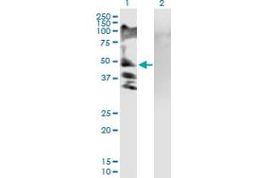 Western Blot analysis of RSC1A1 expression in transfected 293T cell line by RSC1A1 MaxPab polyclonal antibody. (RSC1A1 antibody  (AA 1-617))