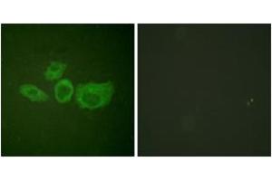 Immunofluorescence analysis of HuvEc cells, using Tyrosine Hydroxylase (Ab-40) Antibody. (Tyrosine Hydroxylase antibody  (AA 41-90))