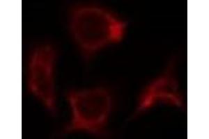 ABIN6278180 staining 293T by IF/ICC. (SOCS2 antibody)