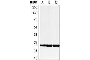 Western blot analysis of LRAT expression in HEK293T (A), SP2/0 (B), H9C2 (C) whole cell lysates. (LRAT antibody  (Center))