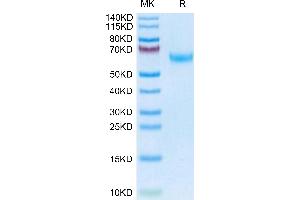 Mouse DDR2 on Tris-Bis PAGE under reduced condition. (DDR2 Protein (AA 22-399) (His tag))