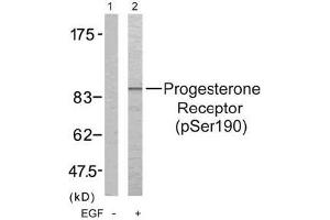 Image no. 3 for anti-Progesterone Receptor (PGR) (pSer190) antibody (ABIN196747) (Progesterone Receptor antibody  (pSer190))