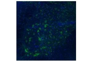 Sample Type : Spinal Cord, ventral horns (TAAR5 antibody  (Middle Region))