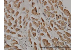 Immunoperoxidase of monoclonal antibody to SPRY1 on formalin-fixed paraffin-embedded human heart. (SPRY1 antibody  (AA 1-110))