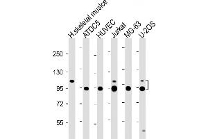 All lanes : Anti-CO Antibody (Center) at 1:2000 dilution Lane 1: Human skeletal muslce lysate Lane 2: ATDC5 whole cell lysate Lane 3: HUVEC whole cell lysate Lane 4: Jurkat whole cell lysate Lane 5: MG-63 whole cell lysate Lane 6: U-2OS whole cell lysate Lysates/proteins at 20 μg per lane. (COMP antibody  (AA 314-343))