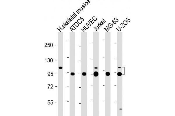 COMP anticorps  (AA 314-343)