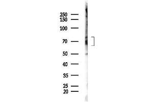 Western blot analysis of lysates from Mouse lung, using  Antibody at 1/1000 dilution.