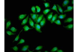 Immunofluorescence staining of A549 cells with ABIN7164376 at 1:166, counter-stained with DAPI. (DHX34 antibody  (AA 418-554))