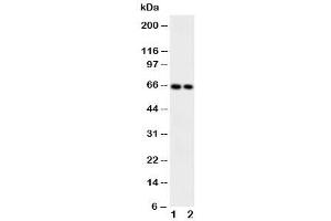 Western blot testing of CaMKK2 antibody and Lane 1:  rat brain (CAMKK2 antibody  (Middle Region))