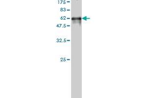 Western Blot detection against Immunogen (57. (PIH1D1 antibody  (AA 1-290))
