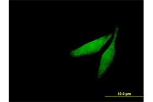 Immunofluorescence of purified MaxPab antibody to CAMK2G on HeLa cell. (CAMKII gamma antibody  (AA 1-527))