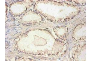 Immunohistochemical of paraffin-embedded human prostate tissue using ABIN7148973 at dilution of 1:200 (CST3 antibody)