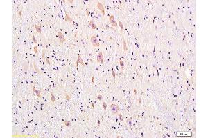 Formalin-fixed and paraffin embedded rat brain tissue labeled with Anti-DRD1 Polyclonal Antibody, Unconjugated  at 1:300, followed by conjugation to the secondary antibody and DAB staining (Dopamine Receptor d1 antibody  (AA 101-200))
