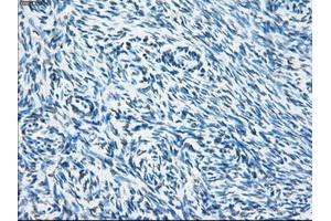 Immunohistochemical staining of paraffin-embedded colon tissue using anti-SORDmouse monoclonal antibody.