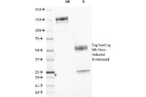 SDS-PAGE Analysis Purified CELA3B Monoclonal Antibody (CELA3B/1218).