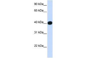 LIAS antibody used at 1 ug/ml to detect target protein. (LIAS antibody  (N-Term))