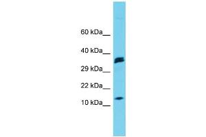 Host: Rabbit Target Name: Map1lc3a Sample Type: Rat Pancreas lysates Antibody Dilution: 1. (MAP1LC3A antibody  (N-Term))