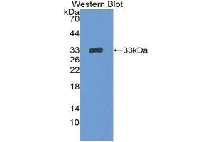 Detection of Recombinant BRCA1, Mouse using Polyclonal Antibody to Breast Cancer Susceptibility Protein 1 (BRCA1) (BRCA1 antibody  (AA 1524-1781))