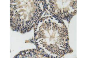 IHC-P analysis of testis tissue, with DAB staining. (SEMA4D/CD100 antibody  (AA 502-636))