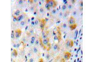 Used in DAB staining on fromalin fixed paraffin-embedded Liver tissue (ADCY2 antibody  (AA 294-525))