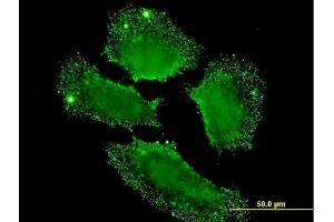 Immunofluorescence of monoclonal antibody to SH2D3C on HeLa cell. (SH2D3C antibody  (AA 1-110))