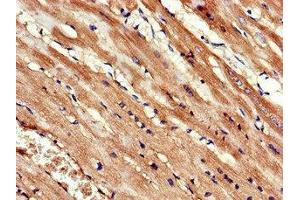 Immunohistochemistry of paraffin-embedded human heart tissue using ABIN7157595 at dilution of 1:100 (KIF14 antibody  (AA 261-531))