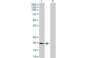 Western Blot analysis of C1orf84 expression in transfected 293T cell line by C1orf84 MaxPab polyclonal antibody.