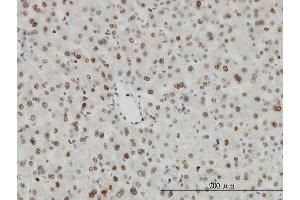 Immunoperoxidase of monoclonal antibody to HDAC1 on formalin-fixed paraffin-embedded human liver. (HDAC1 antibody  (AA 1-482))