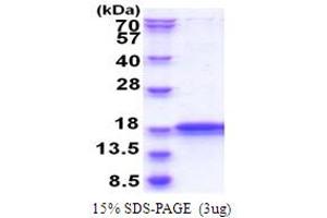 SDS-PAGE (SDS) image for Inner Mitochondrial Membrane Peptidase Subunit 2 (IMMP2L) (AA 38-175) protein (His tag) (ABIN5778668) (IMMP2L Protein (AA 38-175) (His tag))