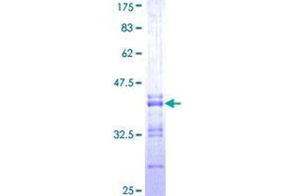 GNPNAT1 Protein (AA 1-90) (GST tag)