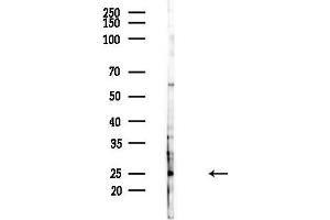 Western blot analysis of lysates from Hela cells(heat-shock,45 min treatment), using APOBEC3A/B Antibody at 1/1000 dilution. (APOBEC3A/B antibody  (Internal Region))