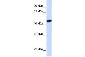 Western Blotting (WB) image for anti-KRR1, Small Subunit (SSU) Processome Component, Homolog (KRR1) antibody (ABIN2458524) (KRR1 antibody)