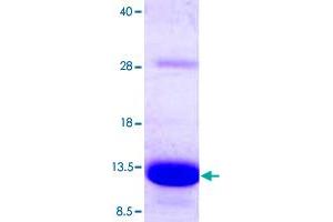 Image no. 1 for S100 Calcium Binding Protein A5 (S100A5) (AA 1-92) protein (His tag) (ABIN5570656)