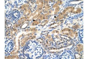 PTPN2 antibody was used for immunohistochemistry at a concentration of 4-8 ug/ml to stain EpitheliaI cells of renal tubule (arrows) in Human Kidney. (PTPN2 antibody  (Middle Region))