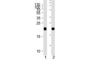 Western Blotting (WB) image for anti-GTPase NRas (NRAS) (AA 70-101) antibody (ABIN3028691)