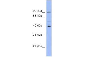 WB Suggested Anti-KCNJ9 Antibody Titration:  0. (KCNJ9 antibody  (Middle Region))