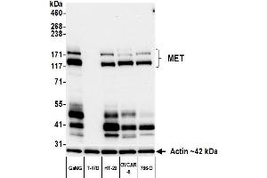 Western Blotting (WB) image for anti-Met Proto-Oncogene (MET) (C-Term) antibody (ABIN7795683)
