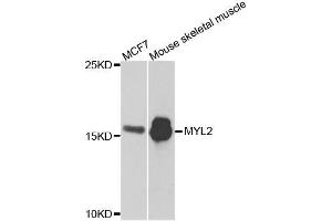 Western blot analysis of extracts of various cell lines, using MYL2 antibody. (MYL2 antibody  (AA 1-166))