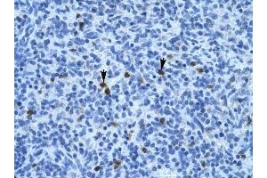 Annexin A3 antibody was used for immunohistochemistry at a concentration of 4-8 ug/ml to stain Spleen cells (arrows) in Human Spleen. (Annexin A3 antibody  (N-Term))