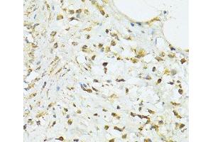 Immunohistochemistry of paraffin-embedded Human vermiform appendix using TRIM15 Polyclonal Antibody at dilution of 1:100 (40x lens). (TRIM15 antibody)