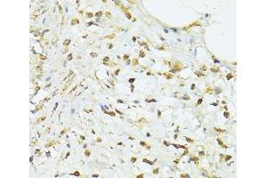 Immunohistochemistry of paraffin-embedded Human vermiform appendix using TRIM15 Polyclonal Antibody at dilution of 1:100 (40x lens).